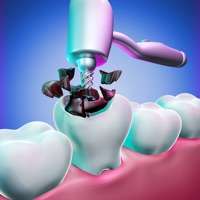 TeethDocios版