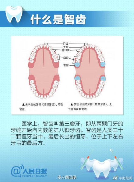 女子智齿反复发炎脸颊烂穿1个洞 注意!这6种智齿不拔掉后患无穷