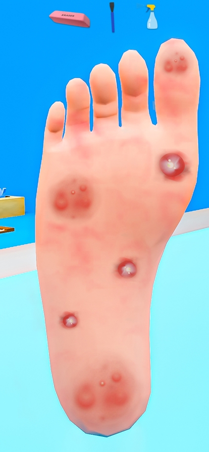 Foot Clinicios版0