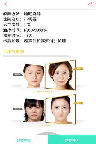 美滴1